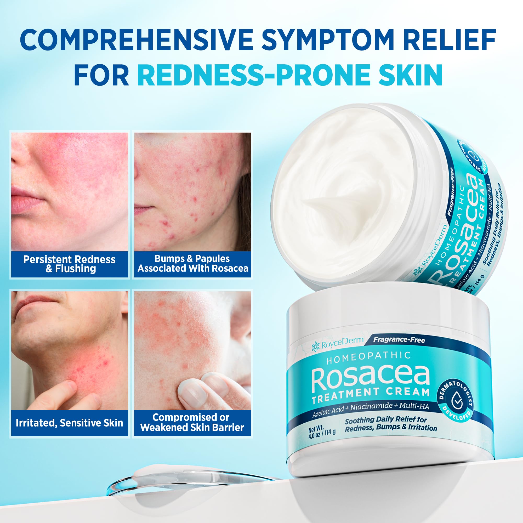 Roycederm Rosacea application on cheek for calm, even tone