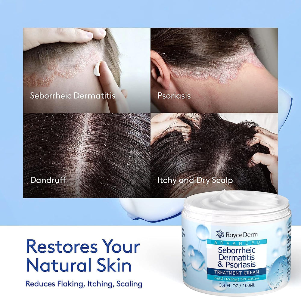 Roycederm scalp-treatment-ointment application on scalp calms itching.