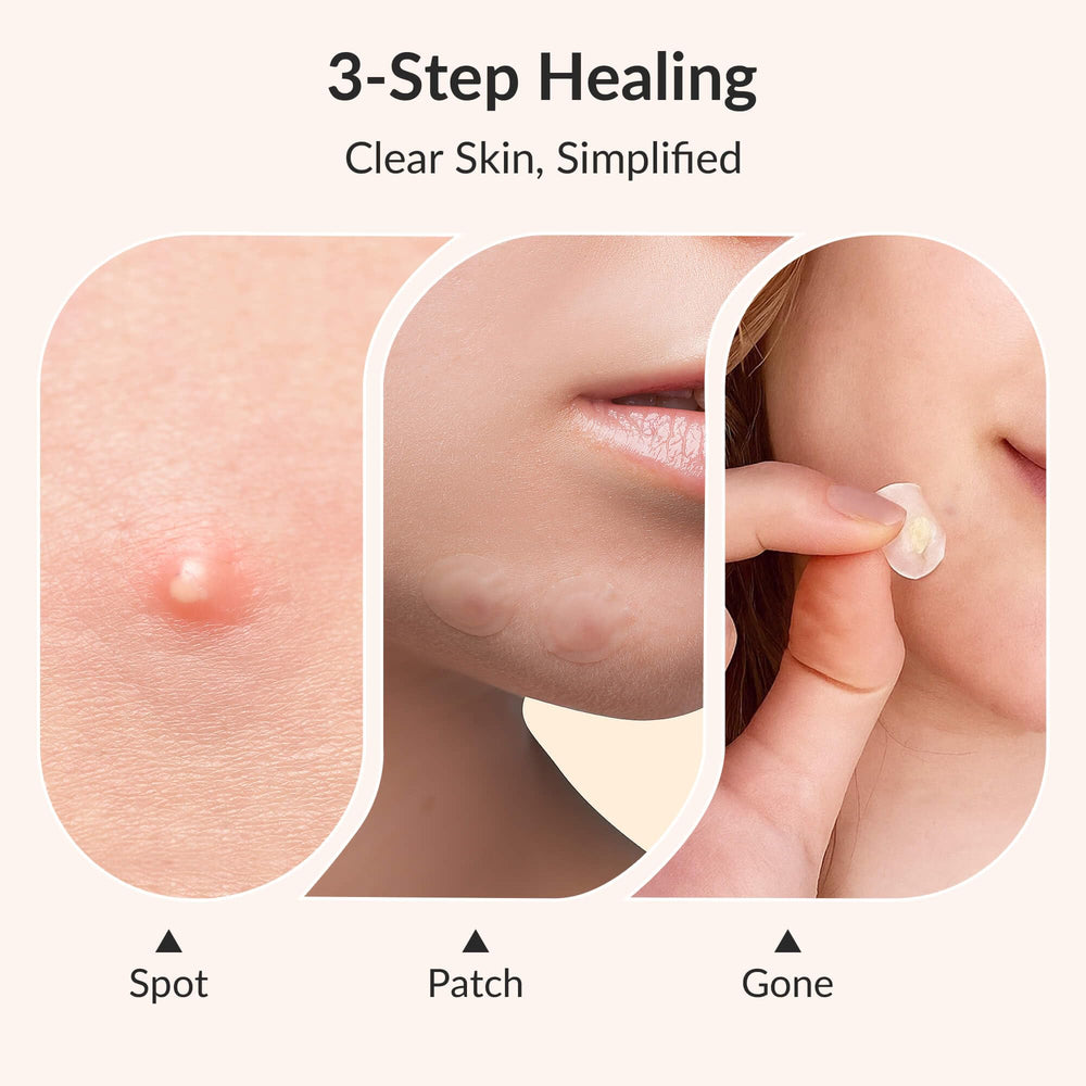 RPE Life Korean Pimple Patches advanced 15mm covers larger breakout