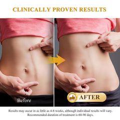 Rvlaim silicone scar cream before-after example suggests reduced redness and improved texture.