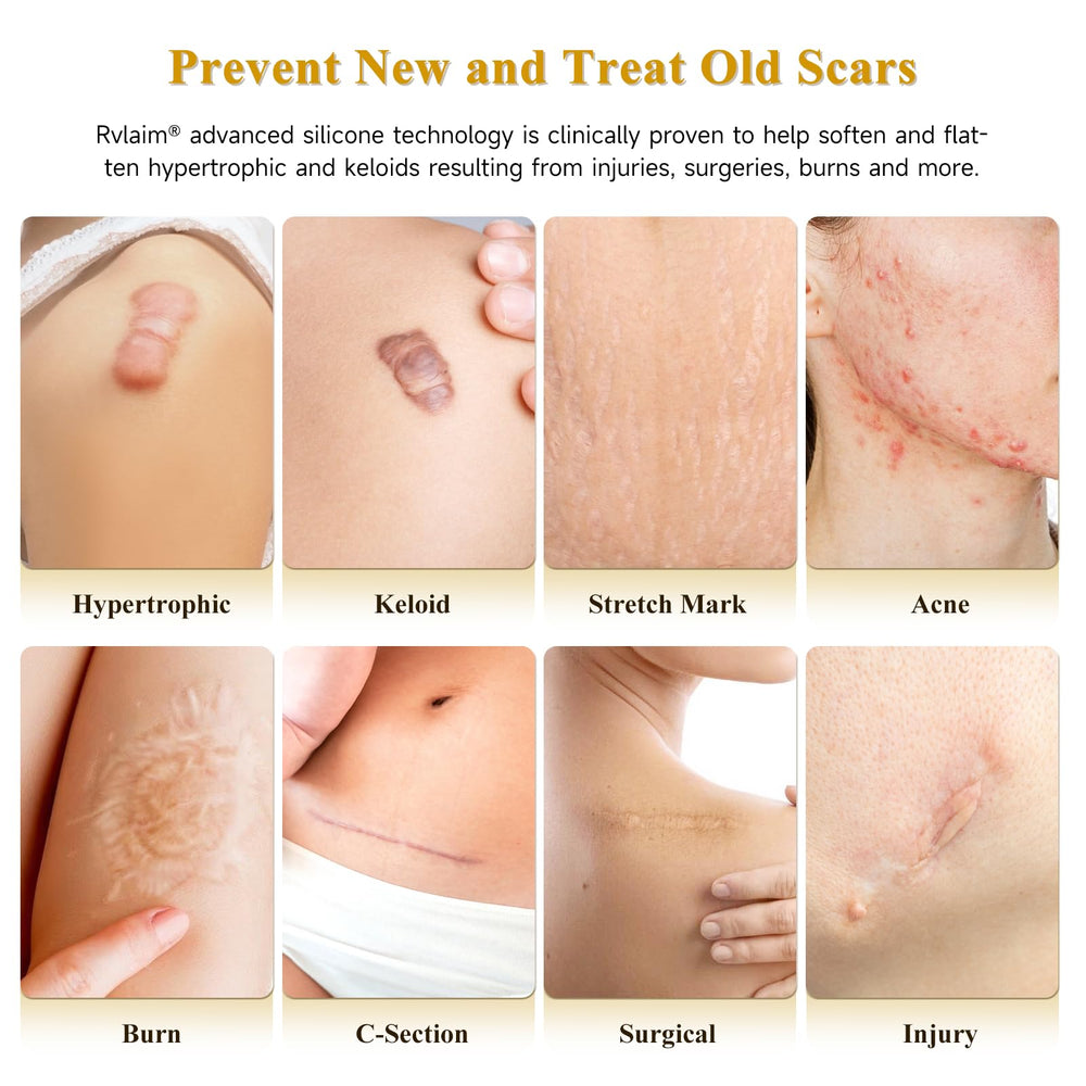 Rvlaim silicone scar cream texture close-up reveals lightweight, non-greasy care.