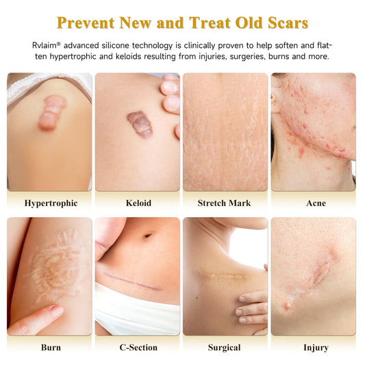 Rvlaim silicone scar cream texture close-up reveals lightweight, non-greasy care.