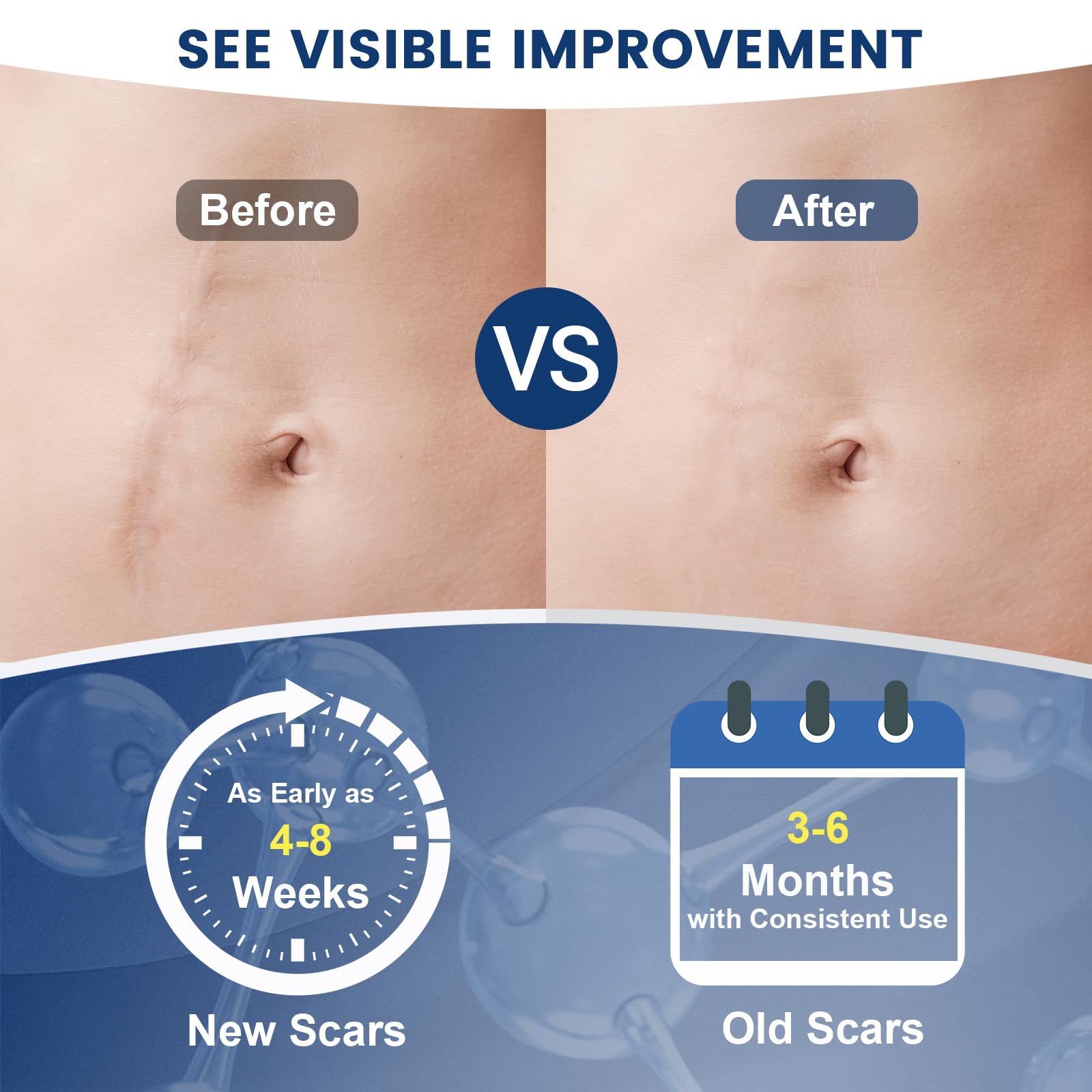 Rvlaim silicone scar gel closeup showing non-greasy absorption