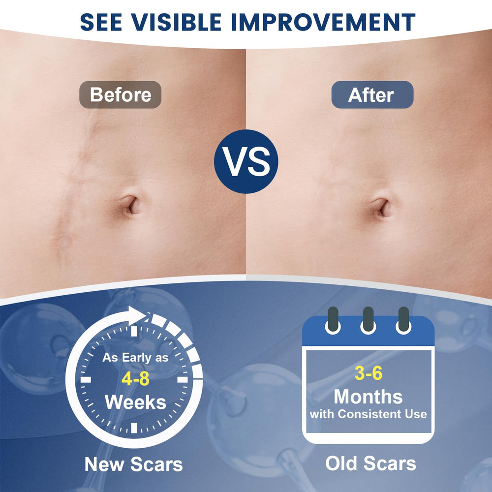 Rvlaim silicone scar gel closeup showing non-greasy absorption