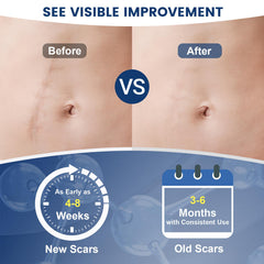 Rvlaim silicone scar gel closeup showing non-greasy absorption