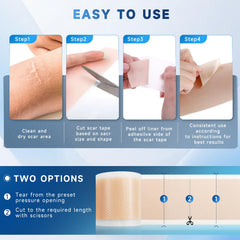Rvlaim silicone scar sheets breathable layer emphasizes comfort for day and night use