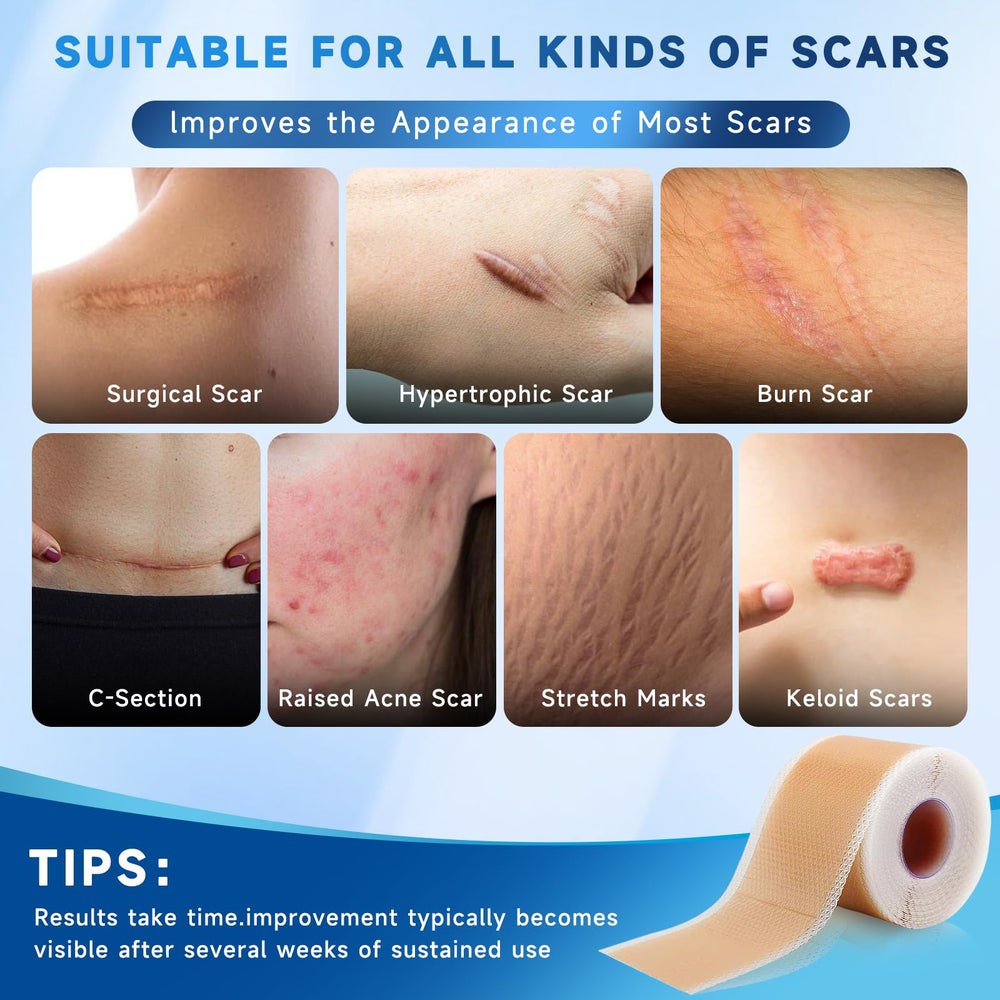 Rvlaim silicone scar sheets cut-to-fit demonstrates customizable sizing for precise coverage