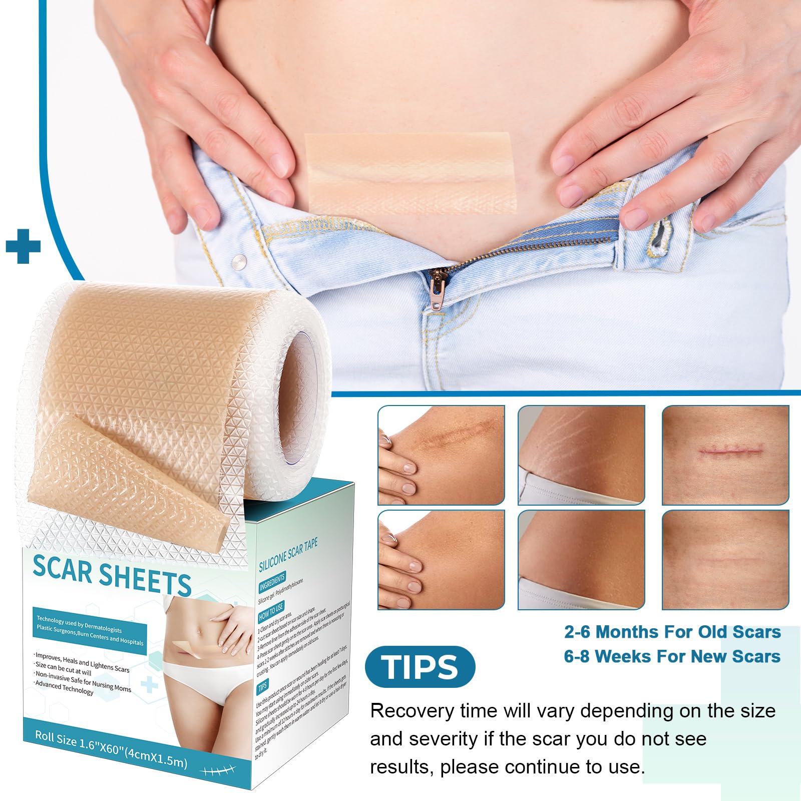 Rvlaim silicone scar sheets moist-healing environment supports gentle recovery