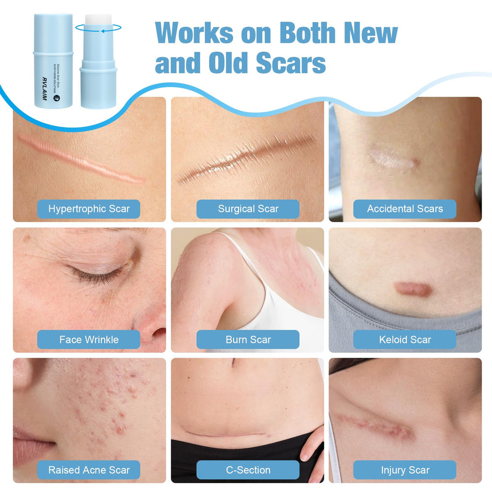 Rvlaim Silicone Scar Stick texture closeup showing smooth film