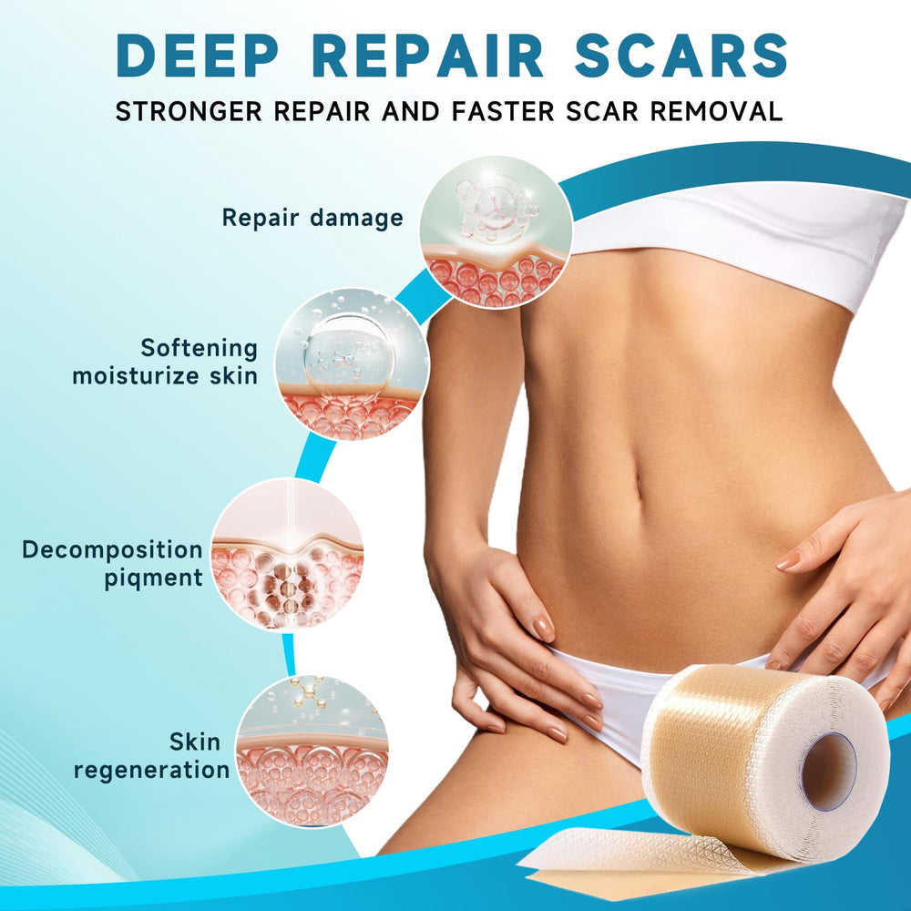 Rvlaim silicone scar tape cut-to-fit easy trim for precise scar coverage