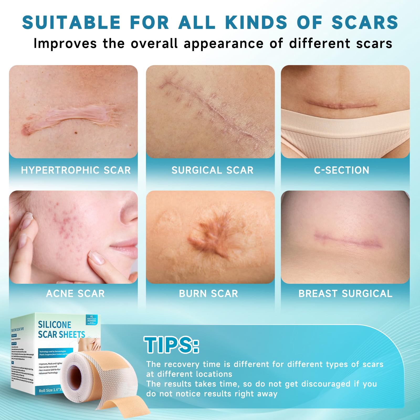 Rvlaim silicone scar tape soft-flexible comfortable wear for extended use