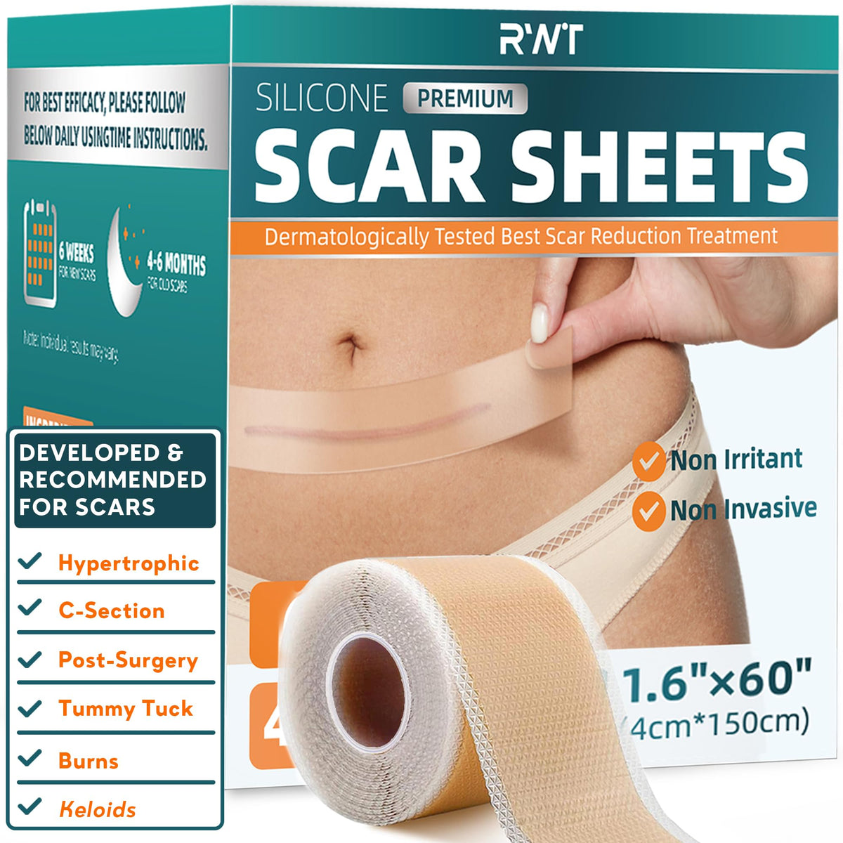 RWT silicone scar sheets roll packaged for easy storage and long-term use
