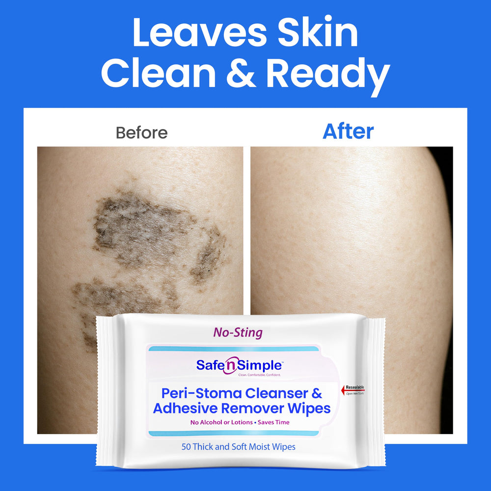 Safe n’ Simple wipe for bandage and tape removal