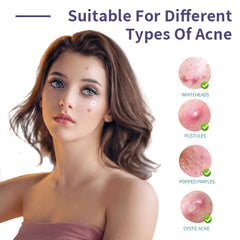 Safirst star heart patches come in 10, 12, and 15 mm for different blemishes.