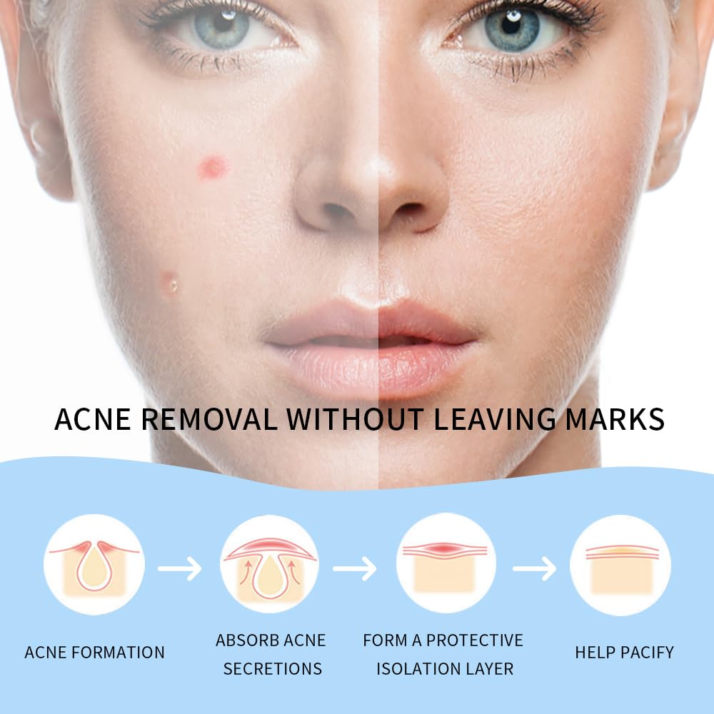 Safirst Star 200-count colorful pack provides versatile blemish coverage.