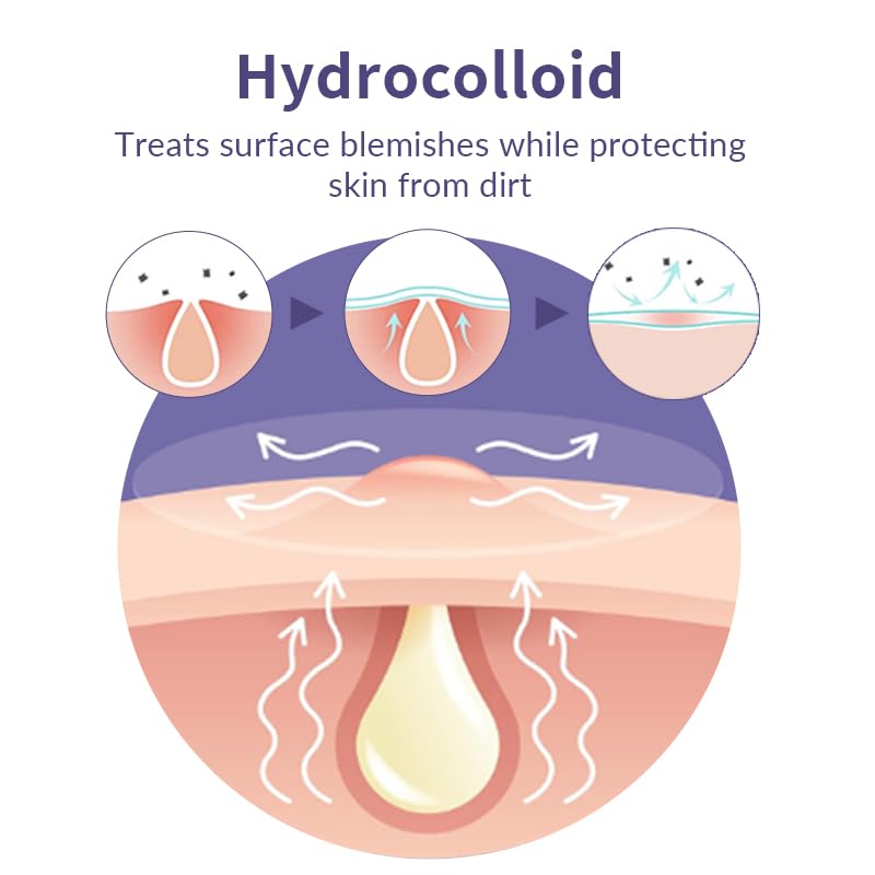 Safirst waterproof patches stay put overnight and protect the blemish area.