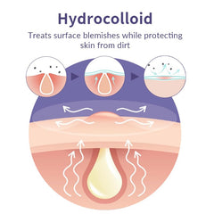 Safirst waterproof patches stay put overnight and protect the blemish area.