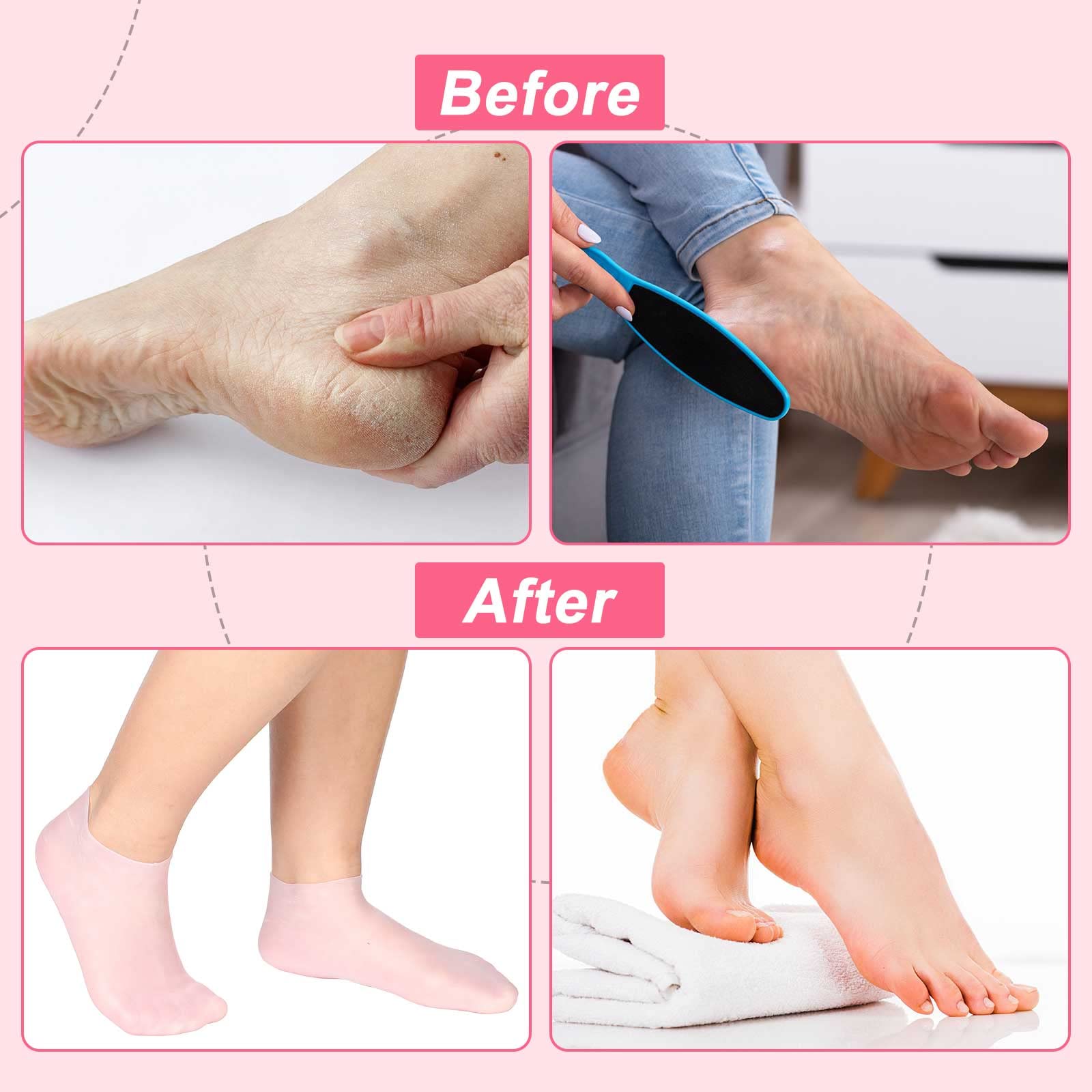 Easy-to-use SATINIOR socks pair with lotion for at-home care