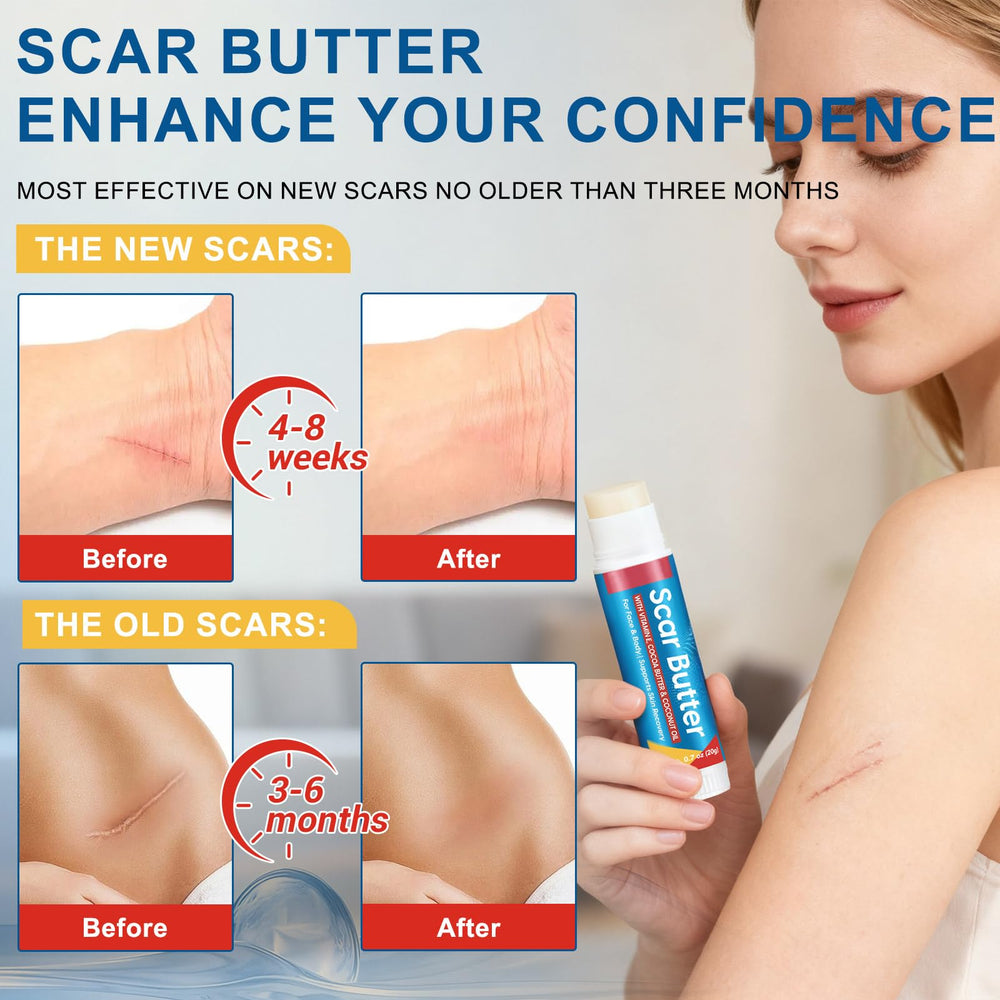 Scar Butter tube packaging highlights portable, travel-friendly skin solution.