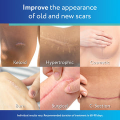 ScarAway silicone sheets on skin demonstrate discreet daily scar management.