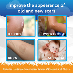 ScarAway Kids gel texture close-up shows non-greasy finish