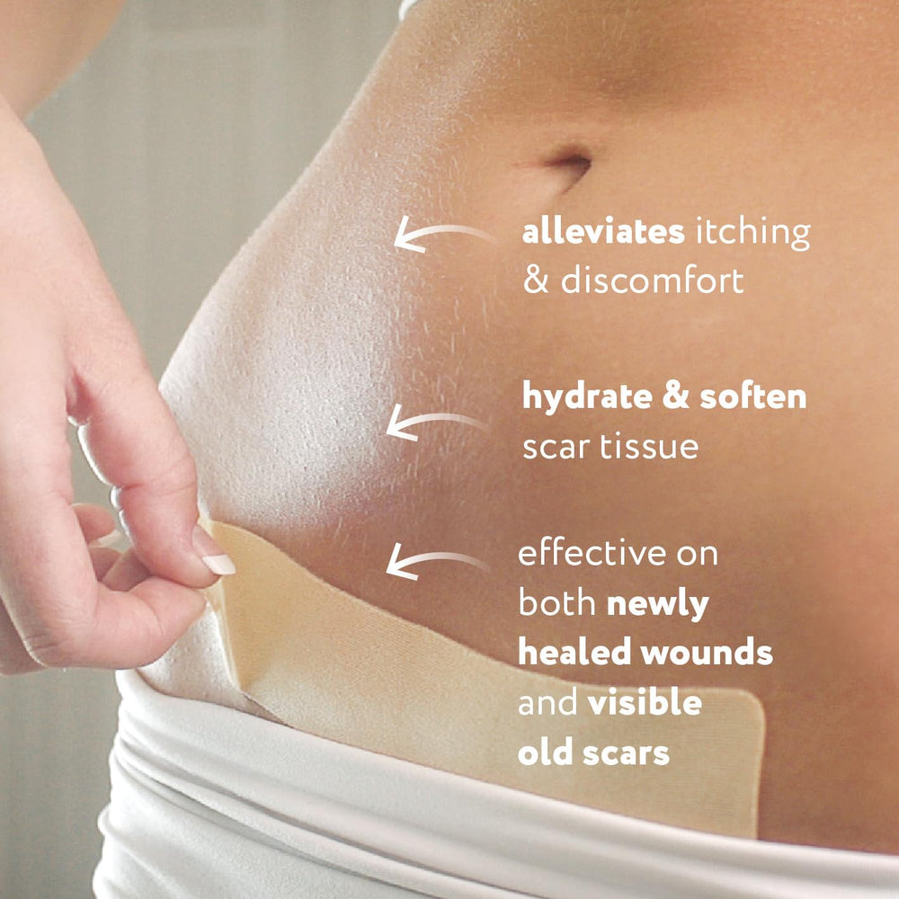 ScarAway reusable silicone scar sheets laid flat for durable, repeated use.