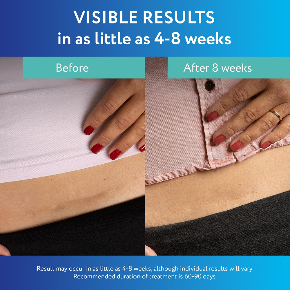 ScarAway silicone sheets cut for smaller scars with precise trimming guides.