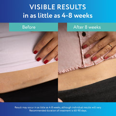 ScarAway silicone sheets cut for smaller scars with precise trimming guides.