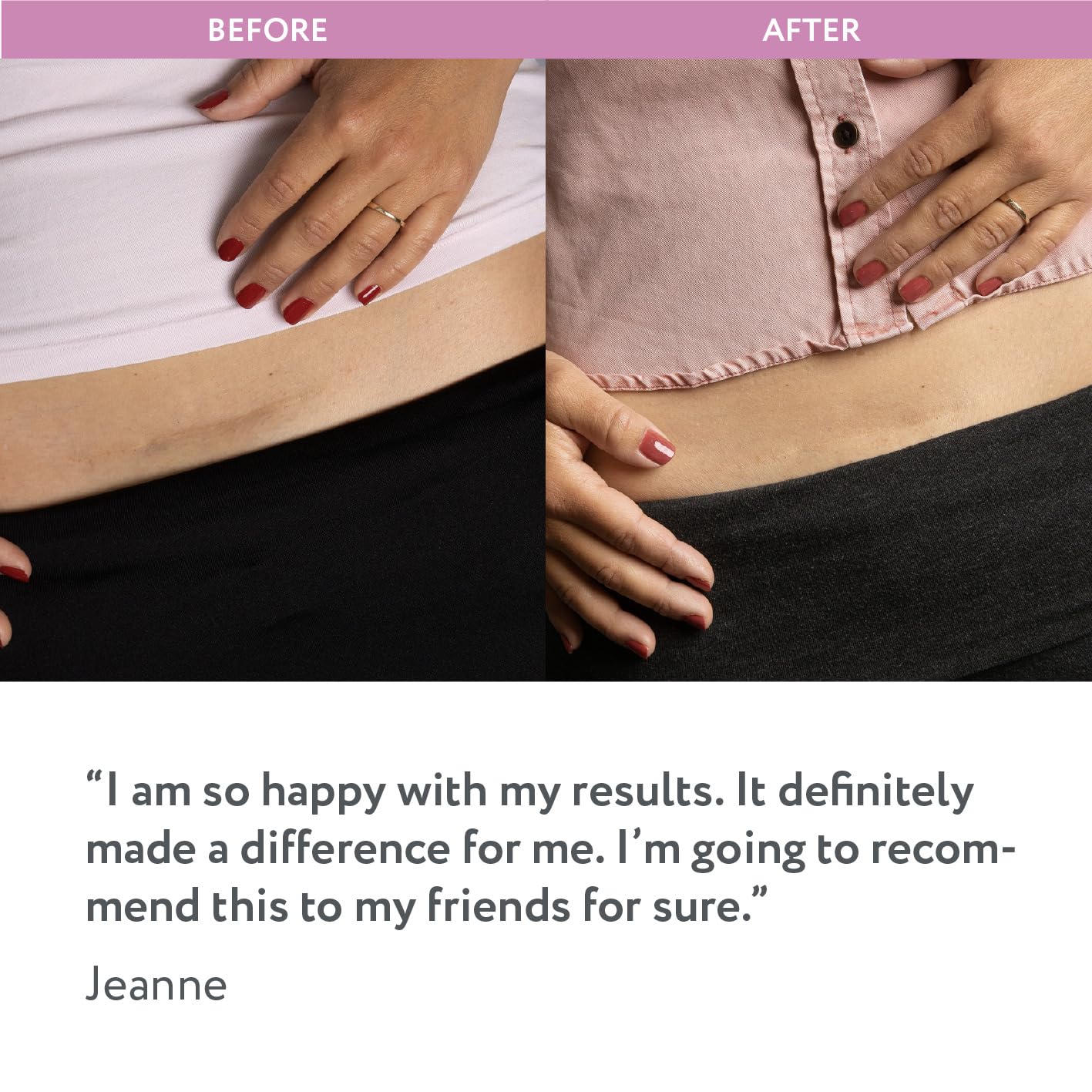 ScarAway sheet being washed to maintain hygiene and longevity.