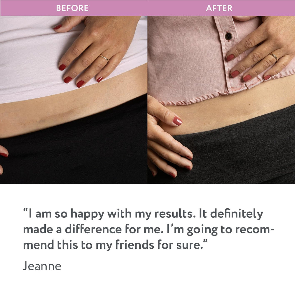 ScarAway sheet being washed to maintain hygiene and longevity.