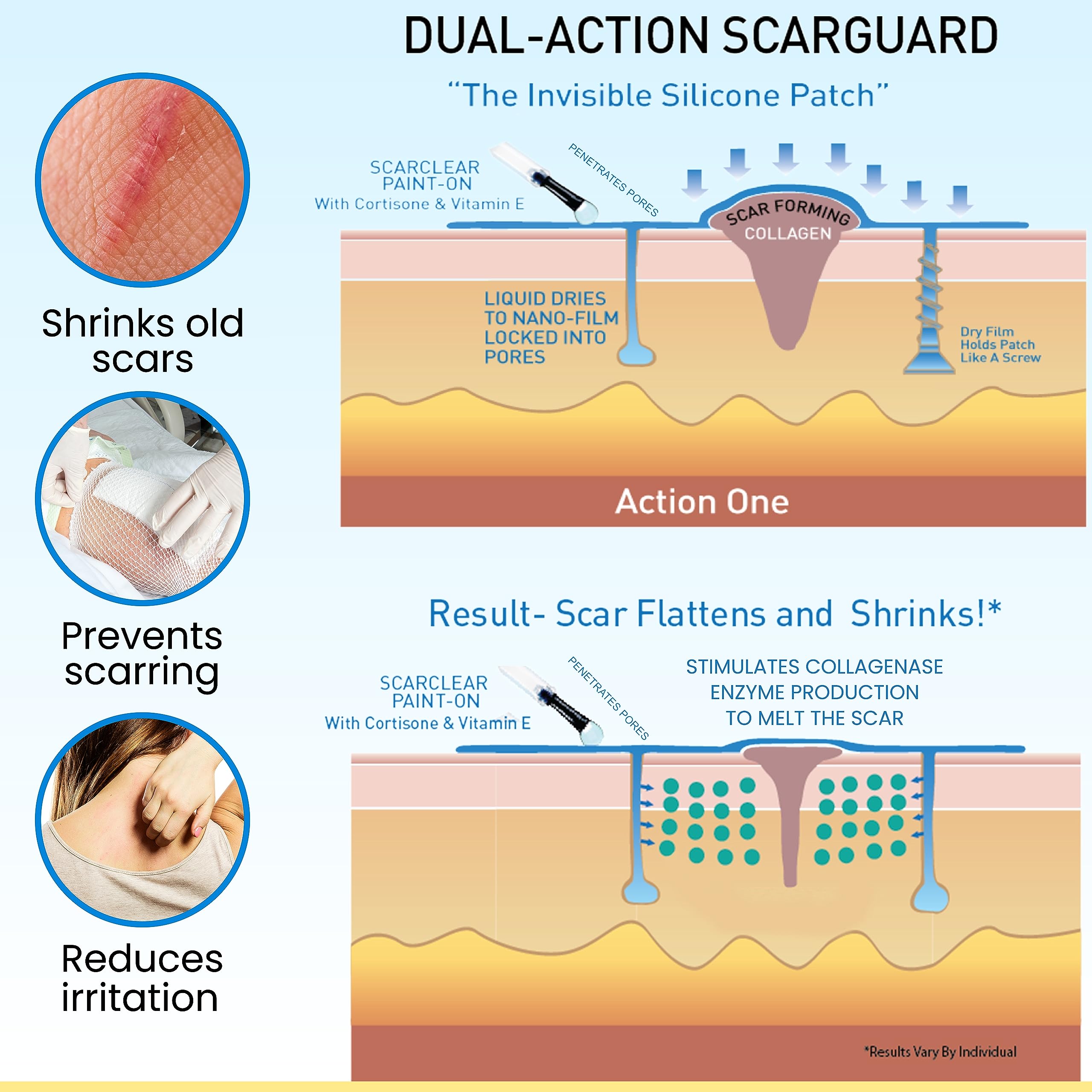 ScarGuard skin-friendly formula reduces irritation without heavy creams