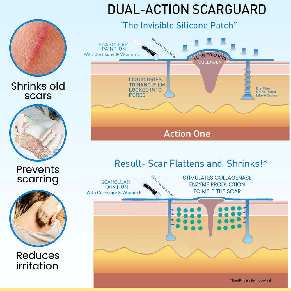 ScarGuard skin-friendly formula reduces irritation without heavy creams