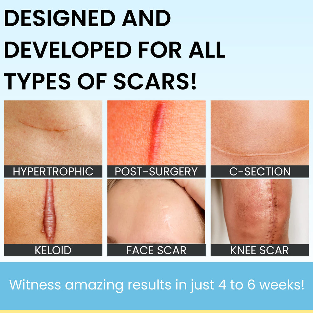 ScarGuard vitamin E delivery supports skin nourishment during scar care
