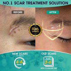 ScarMD gel texture appears clear and non-greasy.