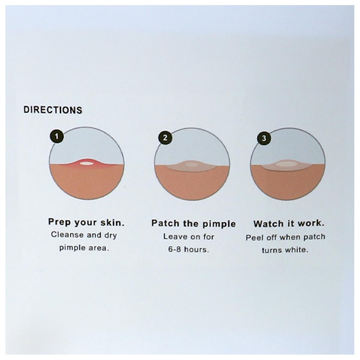 SDA Laboratories Magic Pimple Patch applied to clean, dry skin for best fit.