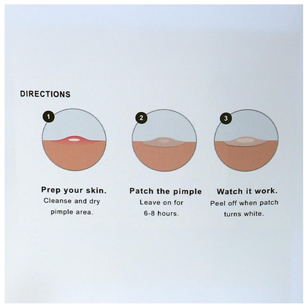 SDA Laboratories Magic Pimple Patch applied to clean, dry skin for best fit.