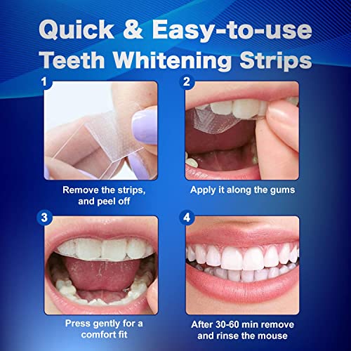Whitening strips applied to teeth during treatment
