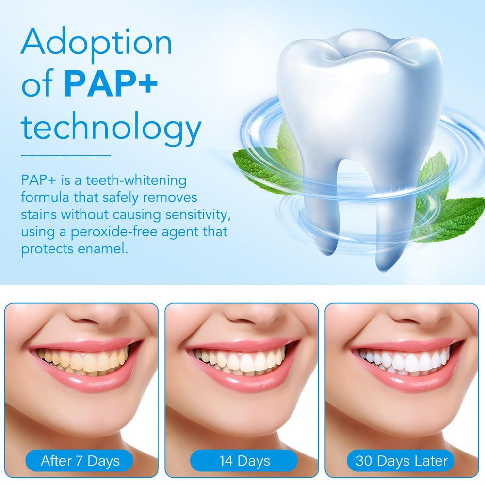Before and after whitening teeth comparison