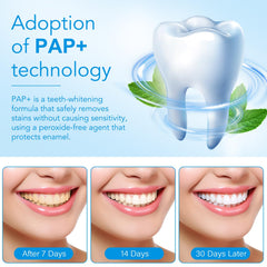 Before and after whitening teeth comparison