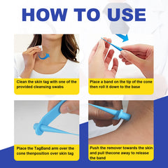 SHISUIZHE hands holding device during treatment visualization