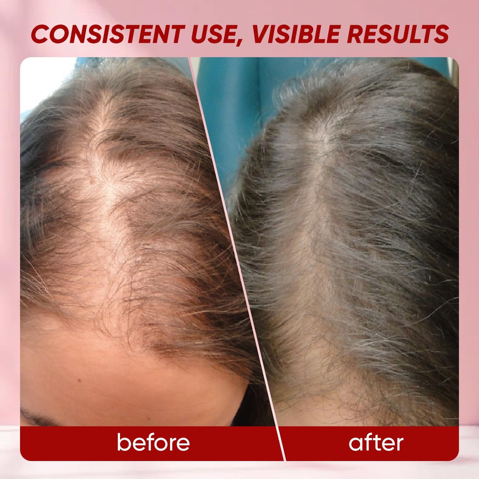 Graphic illustrating hair growth, strength, and nail/skin benefits