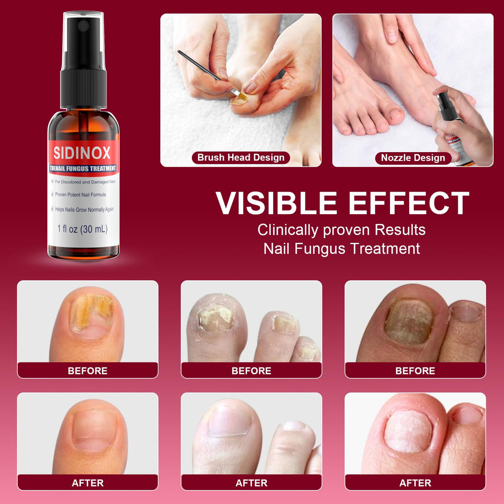 Sidinox five-pack packaging provides convenient nail care value.