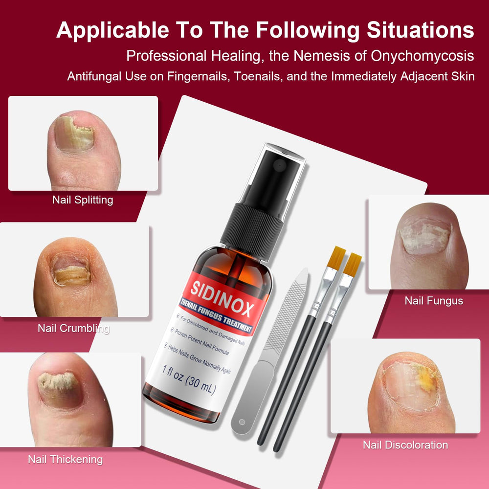 Sidinox brush-and-nozzle applicator enables easy daily nail application.