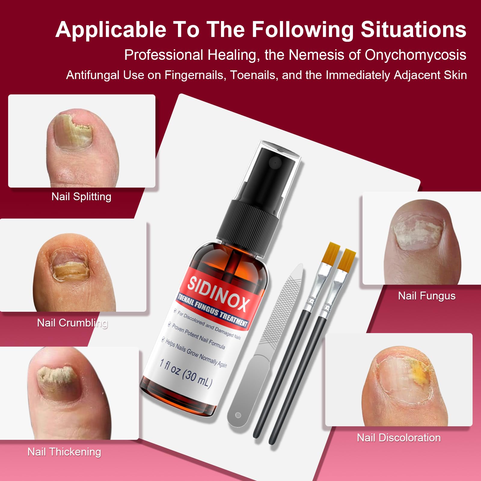 Sidinox brush-and-nozzle applicator enables easy daily nail application.