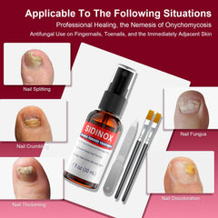Sidinox brush-and-nozzle applicator enables easy daily nail application.