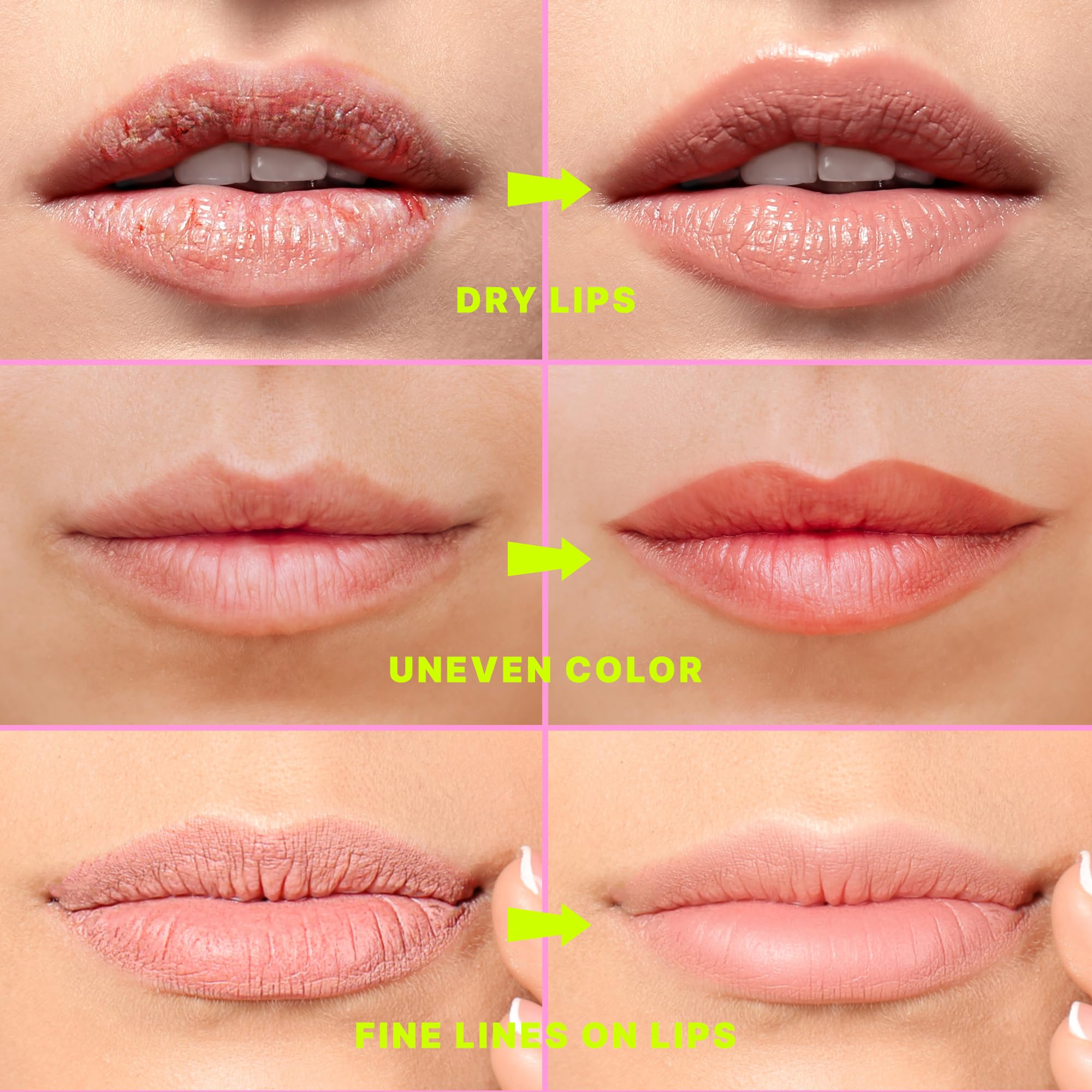 Sielkin lip mask packaging box highlighting premium lip care and gifting appeal
