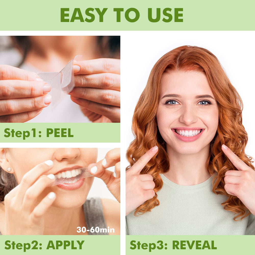 At-home use of Sierra Clean whitening strips for quick results