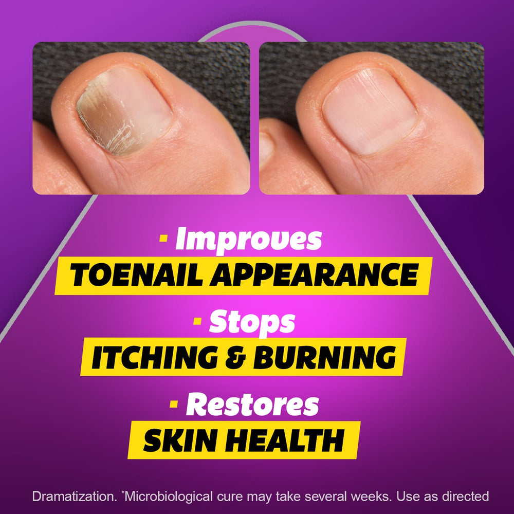 Silka Tolnaftate 1% bottle angled to emphasize maximum-strength formula.