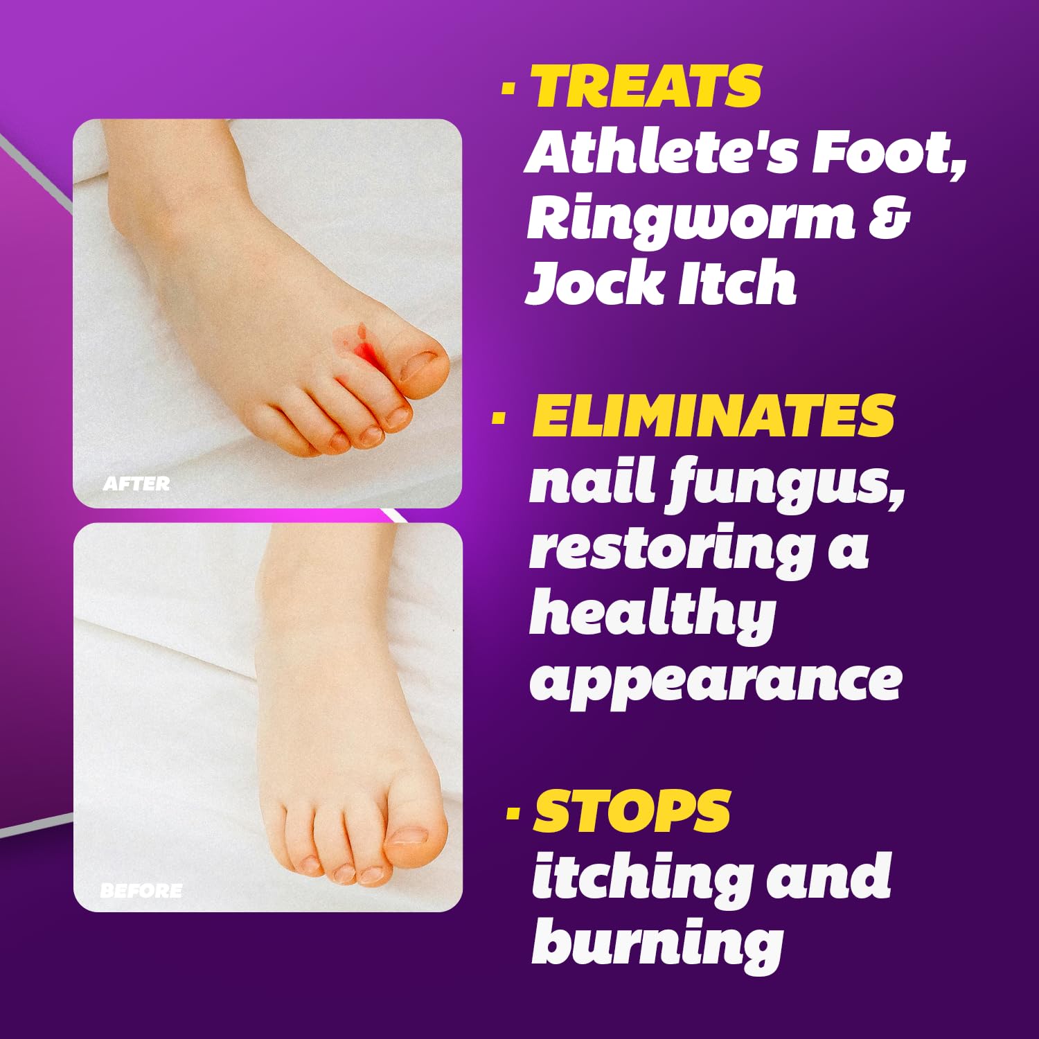 Silka Max Strength Cream Tube shows maximum-strength formula for fast itching and burning relief.
