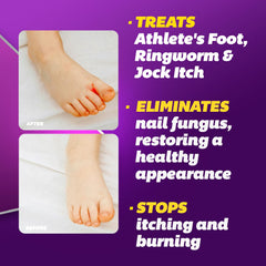 Silka Max Strength Cream Tube shows maximum-strength formula for fast itching and burning relief.